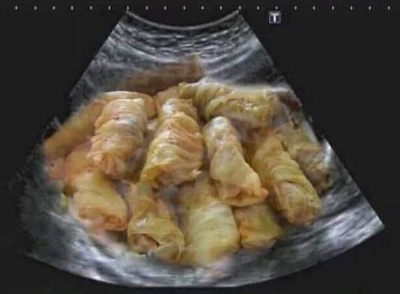 A héten negyedszerre 🙂