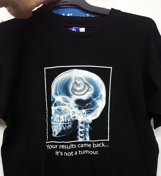 Megjött az hivatalos röntgen eredményed