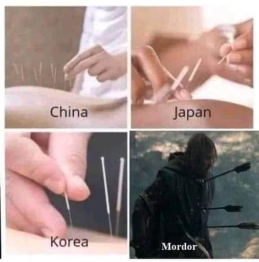 Akupunktúrás kezelések